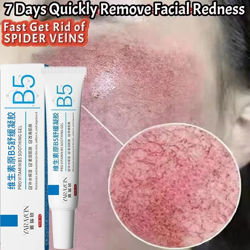 Luxury Skincare Brands - Facial Redness Repair Cream Improve Sensitive