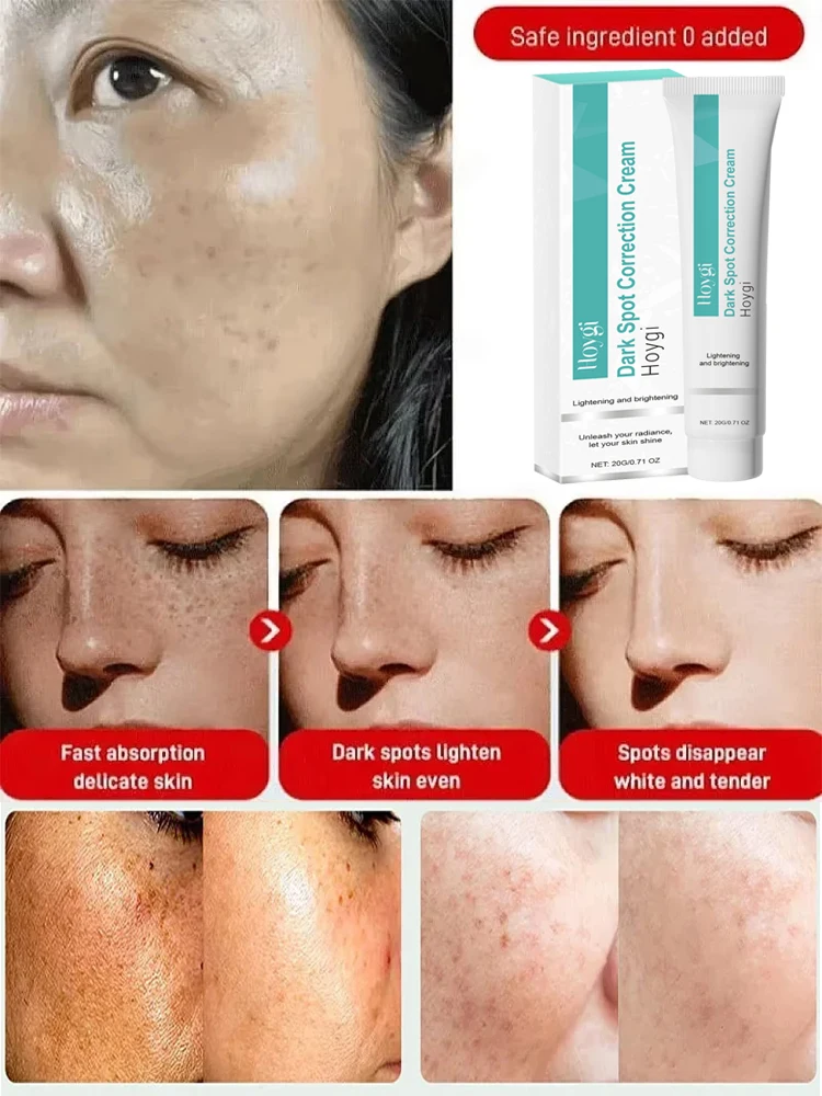 Powerful Spot-removing Whiten  - огляд і ціна Luxury Skincare Brands