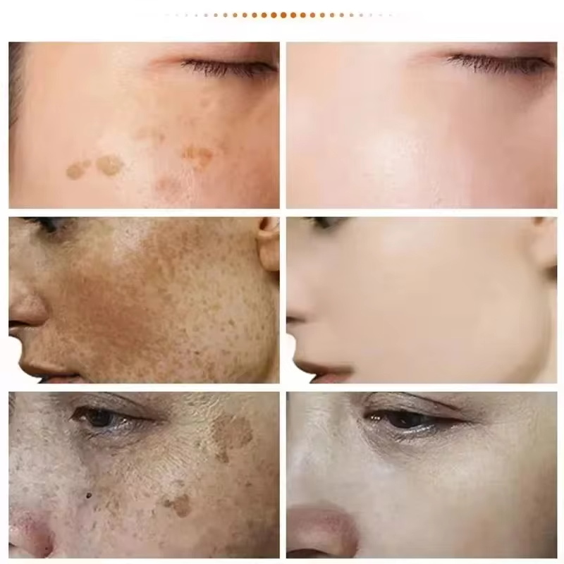 Powerful Spot-removing Whiten  - огляд і ціна Luxury Skincare Brands