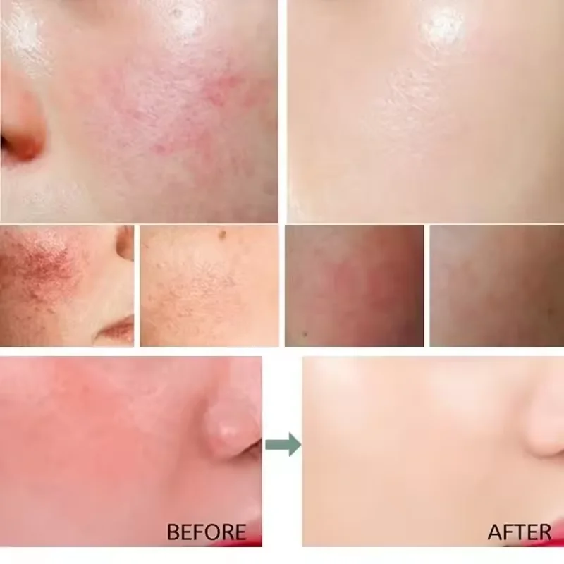 Facial Redness Repair Cream Im - огляд і ціна Luxury Skincare Brands