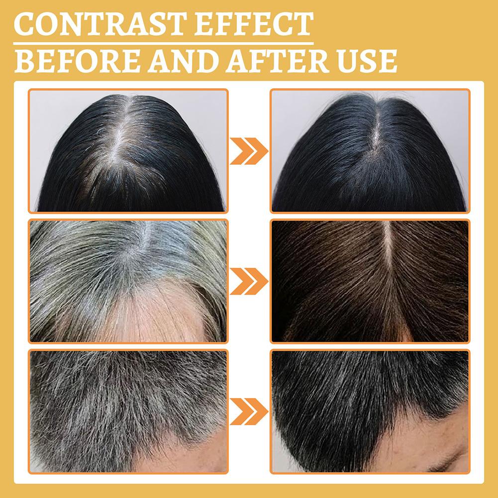 1/2PCS Hair Growth Serum Oil,  - огляд і ціна Growth Factor Serum