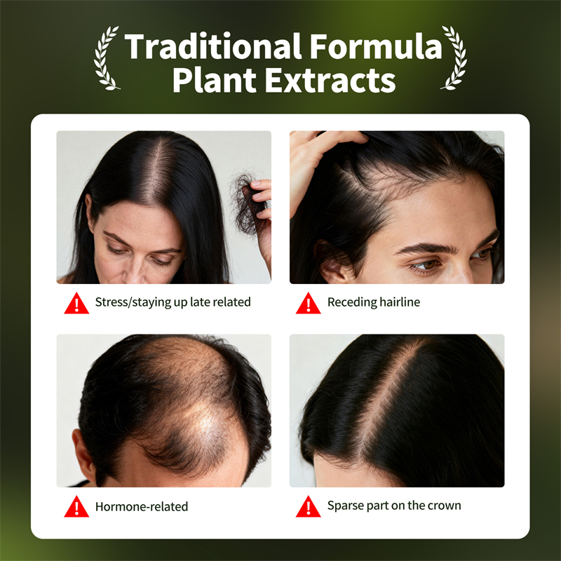 Natural Hair Growth Set Usman  - огляд і ціна Growth Factor Serum