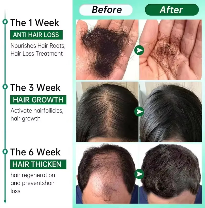 Hair Growth Serum 7 Days Fast  - огляд і ціна Growth Factor Serum