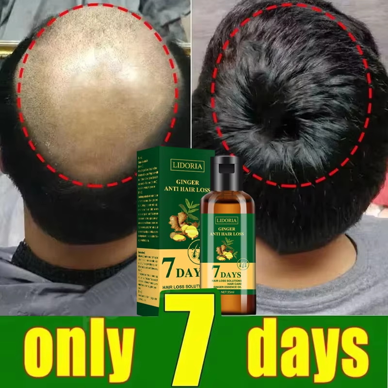 Hair Growth Serum 7 Days Fast  - огляд і ціна Growth Factor Serum