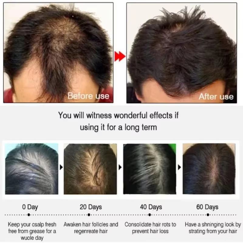 Hair Growth Serum 7 Days Fast  - огляд і ціна Growth Factor Serum