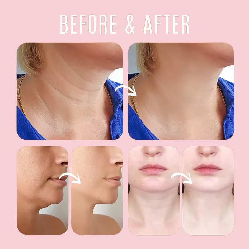 Collagen Wrinkle Removal Multi - огляд і ціна Luxury Skincare Brands