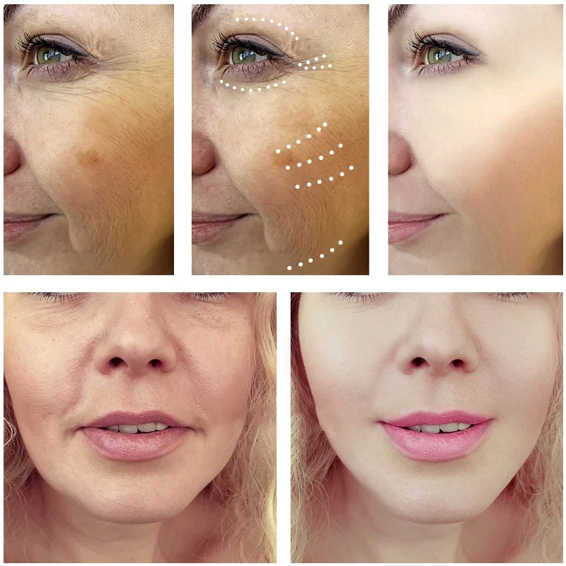 Royal Dragon Blood Serum Place - огляд і ціна Placenta Extract Serum